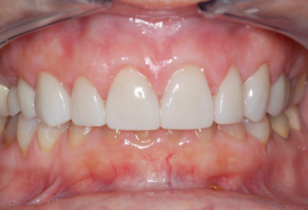 Case 19: after dental treatment