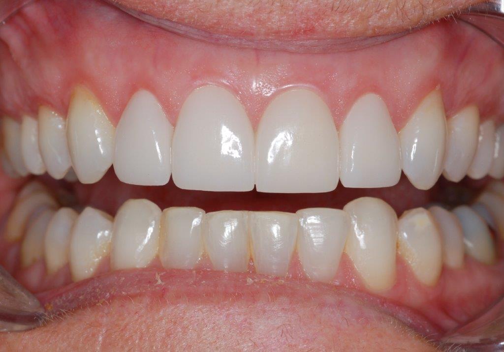 Case 2: after dental treatment