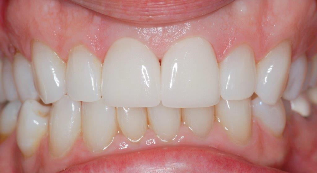 Case 20: after dental treatment