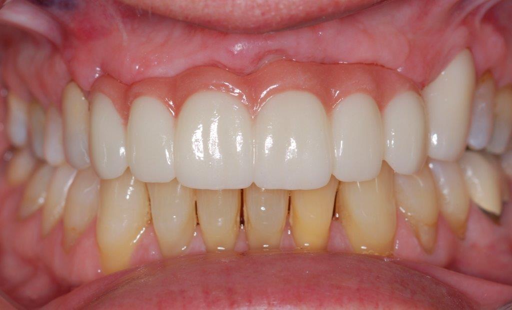 Case 23: after dental treatment