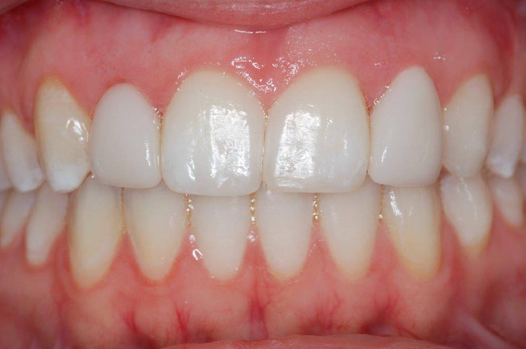 Case 4: after dental treatment