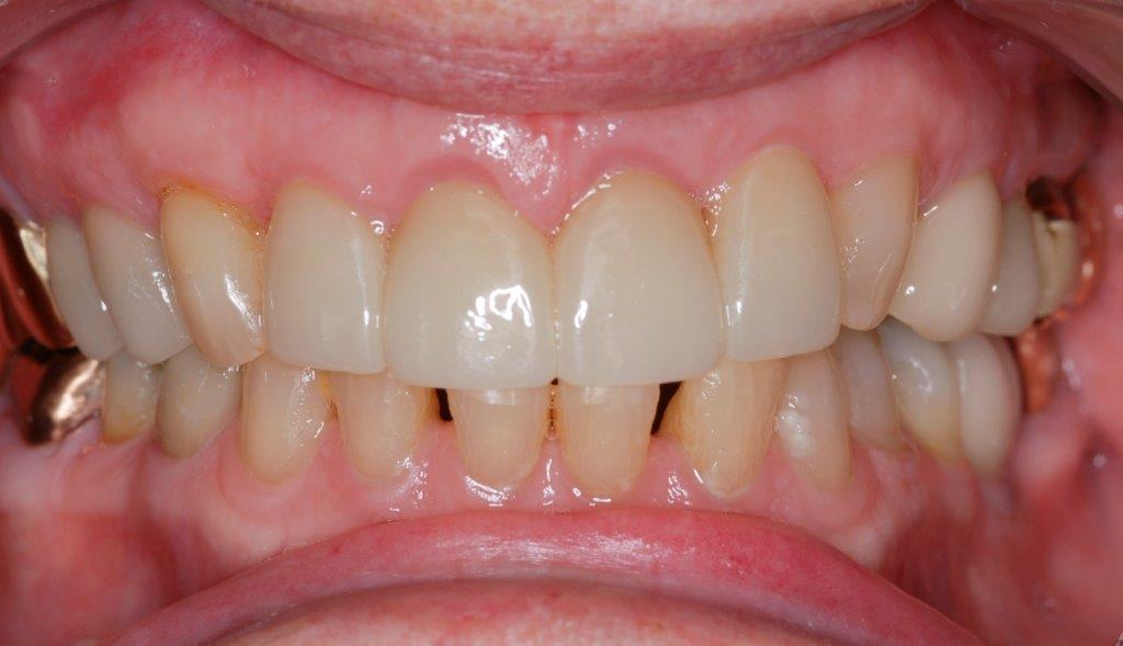 Case 5: after dental treatment