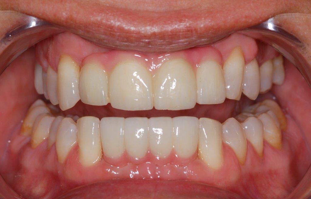 Case 6: after dental treatment