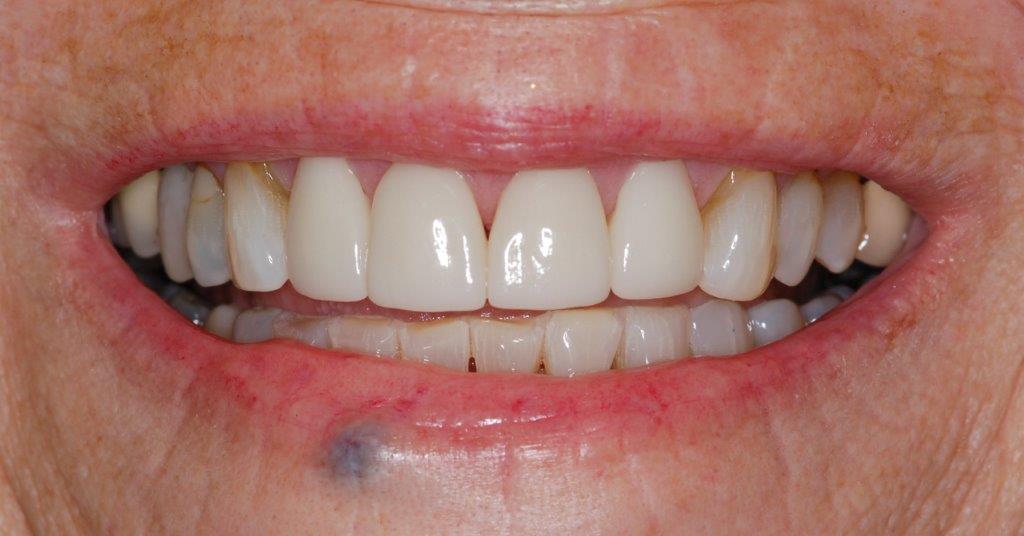 Case 7: after dental treatment