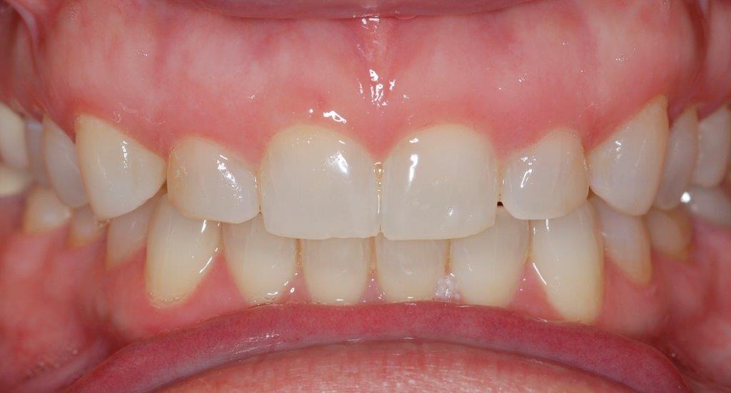 Case 12: before dental treatment