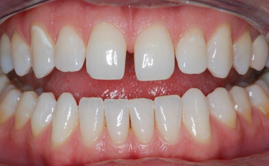 Case 15: before dental treatment