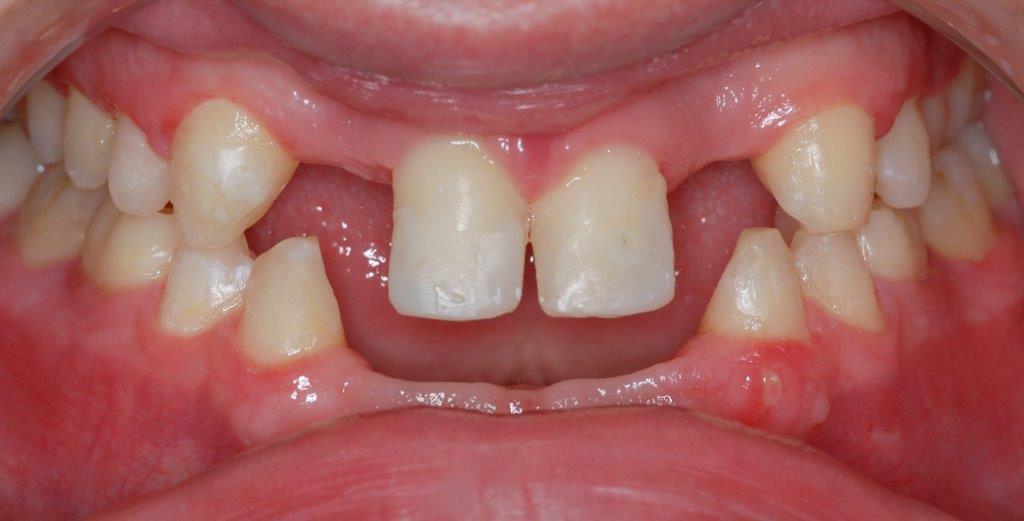 Case 18: before dental treatment