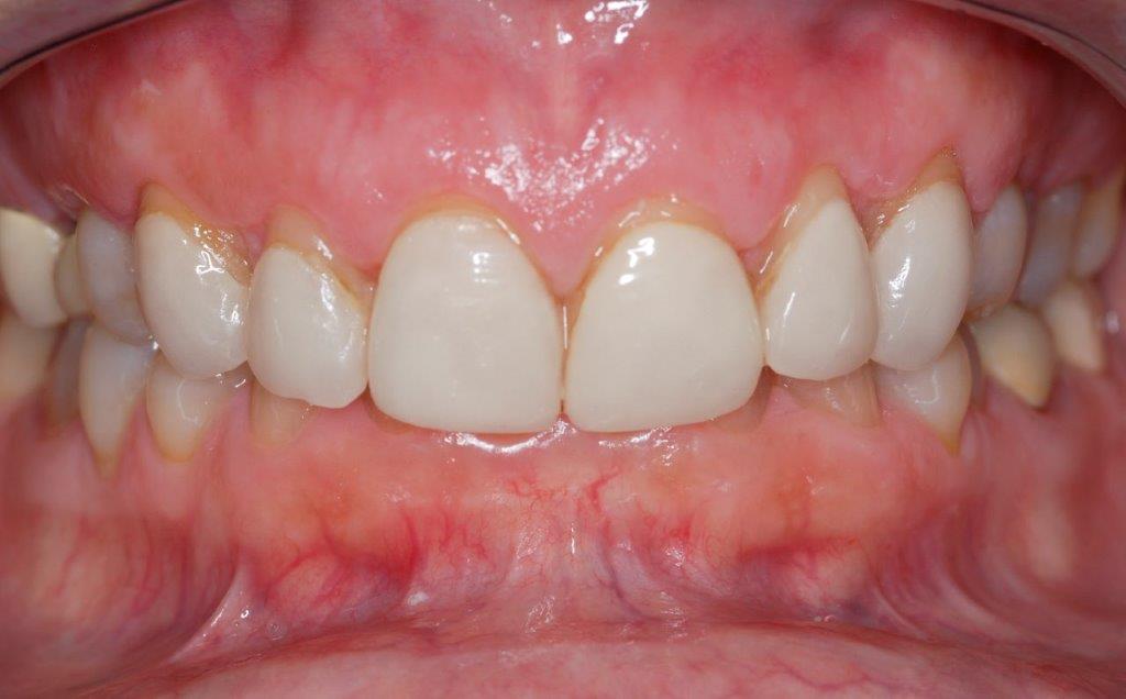 Case 19: before dental treatment