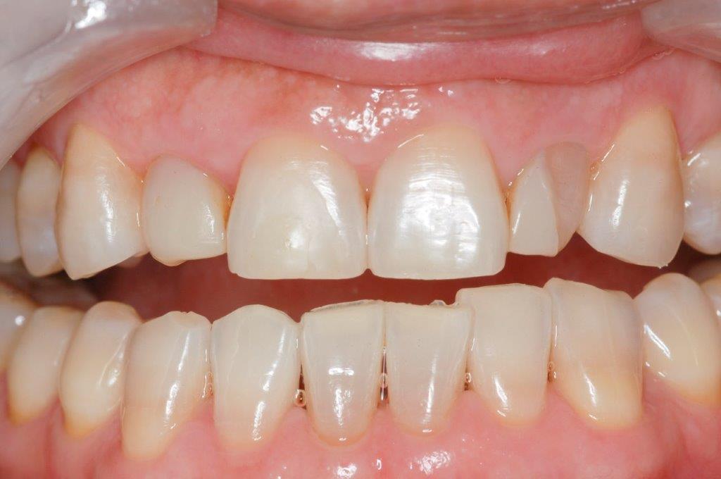 Case 21: before dental treatment