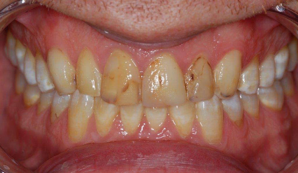 Case 3: before dental treatment