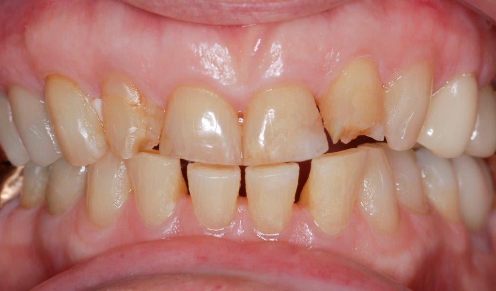 Case 5: before dental treatment